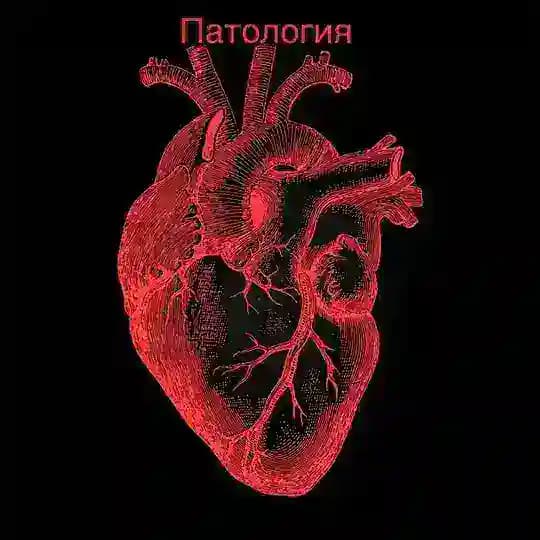 Патология 💉🩸