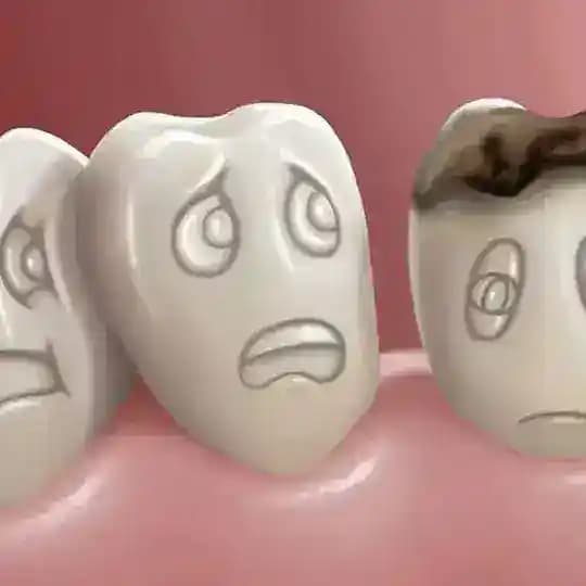 Periodont and periodontitis