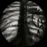 Flower in My Lung