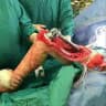 عمليات جراحية 🔪