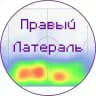Правый Латераль