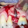 Dental