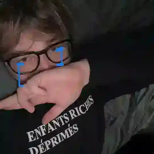 дисфония О_о