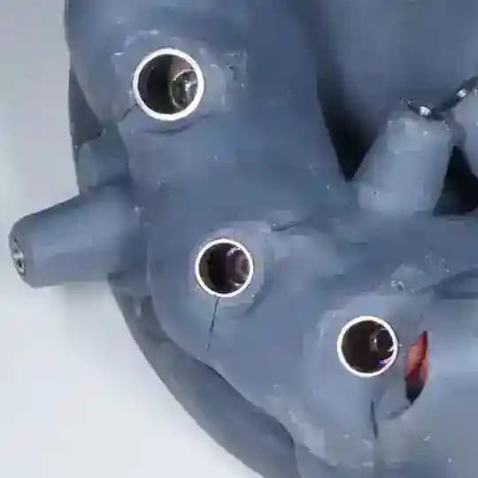 Guided Surgery