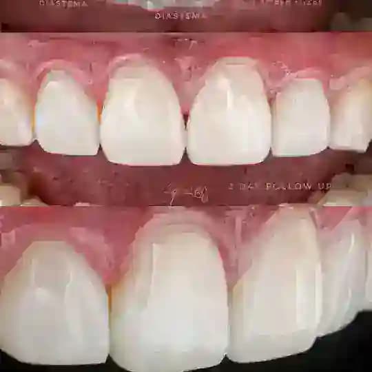 I.D.C || طبيب اسنان عراقي