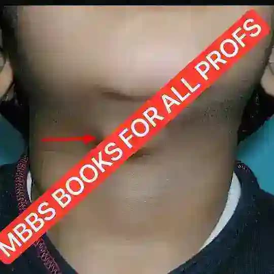 MBBS BOOK PDFs