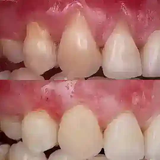 Microsurgery Perio Lab