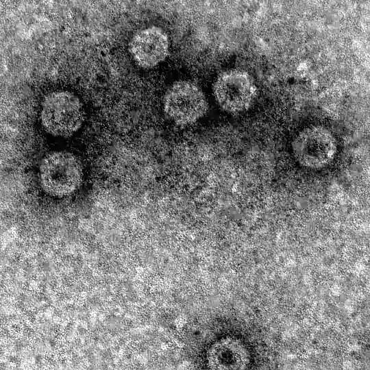 Вирусофобия (Disease X)