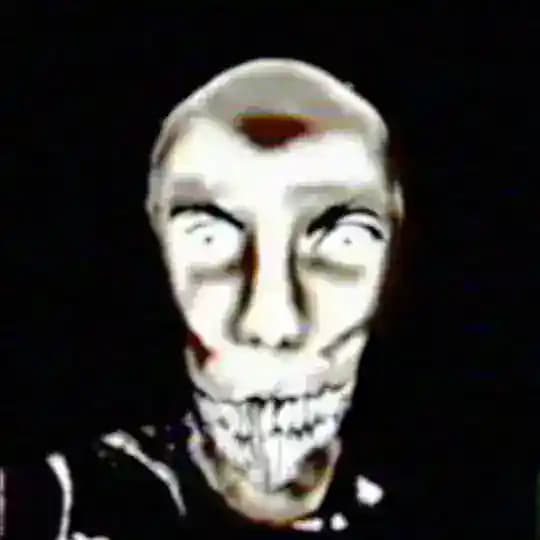vykett