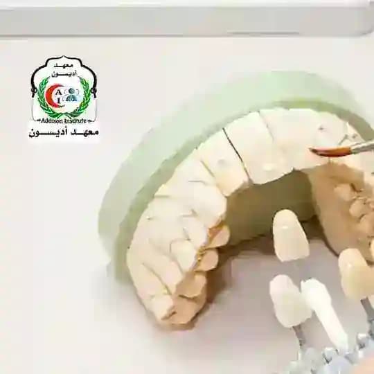 كورسات فني الأسنان