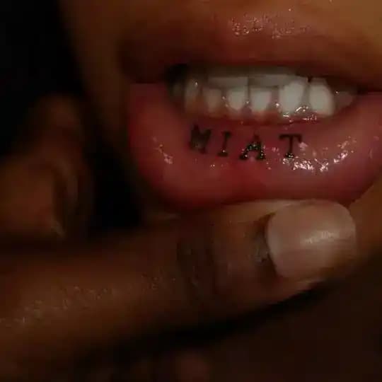 MIAT
